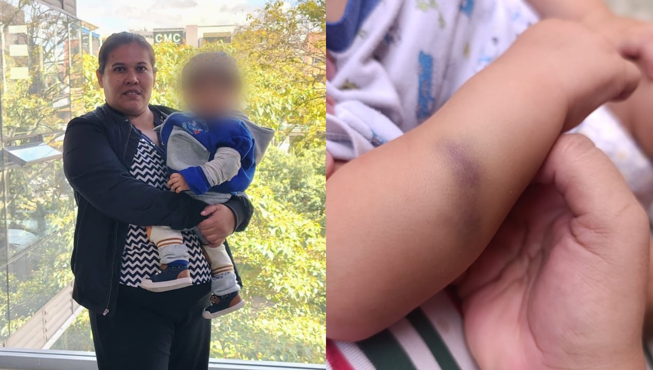 Hendrick Samuel tiene 17 meses y padece hemofilia A severa. Fue diagnosticado a los cuatro meses y no recibía su medicamento desde diciembre de 2025.