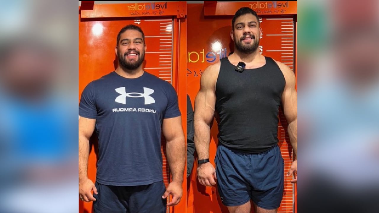 Este hombre se sometió a dos cirugías para lograr una mayor altura.