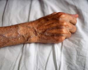 La Fleboterapia Regenerativa es el tratamiento para la curación, reparación y eliminación de todo tipo de varices