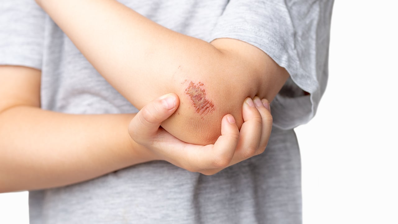 Existen varios tipos de heridas.