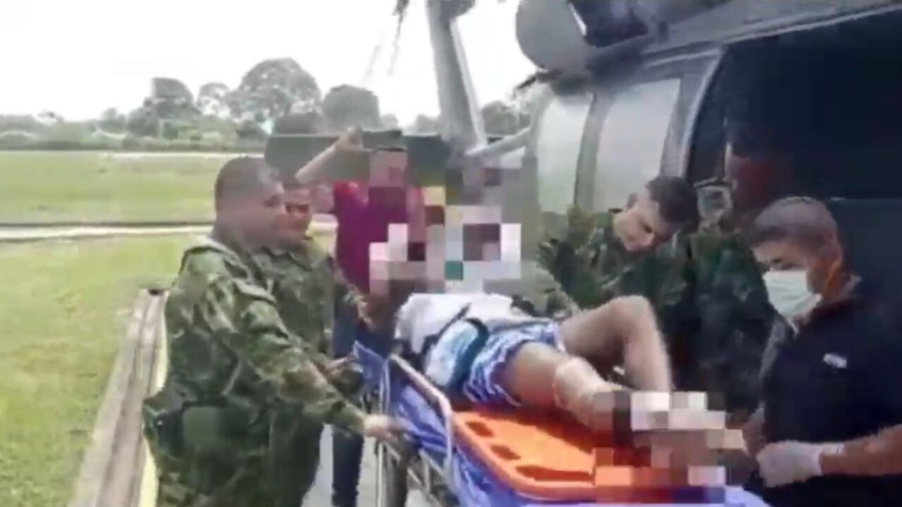 Mientras ELN secuestra soldados, las FF.MM salvan la vida de un guerrillero que pisó una mina, esta es la historia