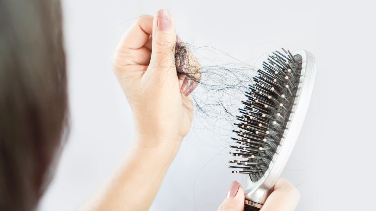 Esta afección puede generar a que el cabello comience a deteriorarse.