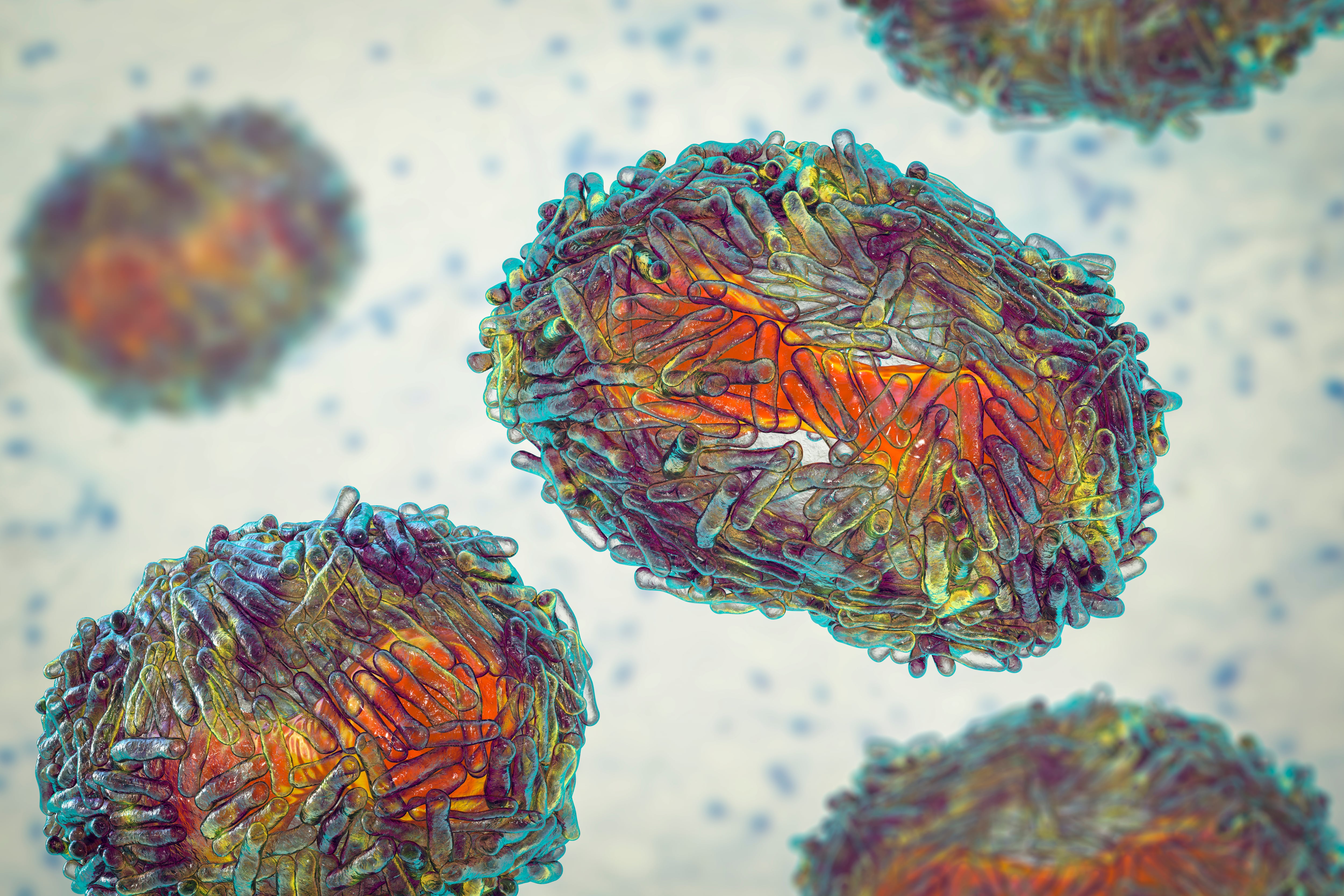 La OMS explica que la viruela símica puede causar una variedad de signos y síntomas, con síntomas variables.