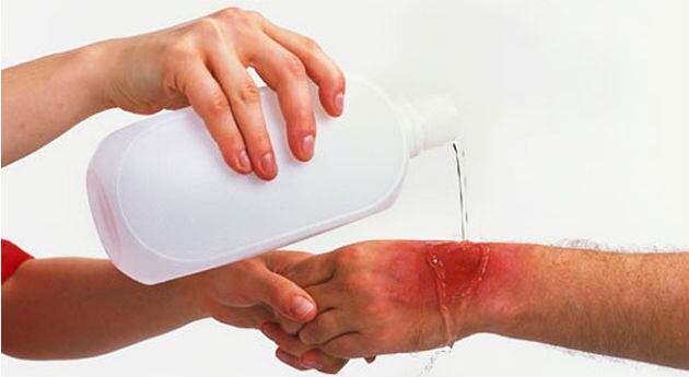 Para aliviar quemaduras en la piel no se debe usar aceites. 