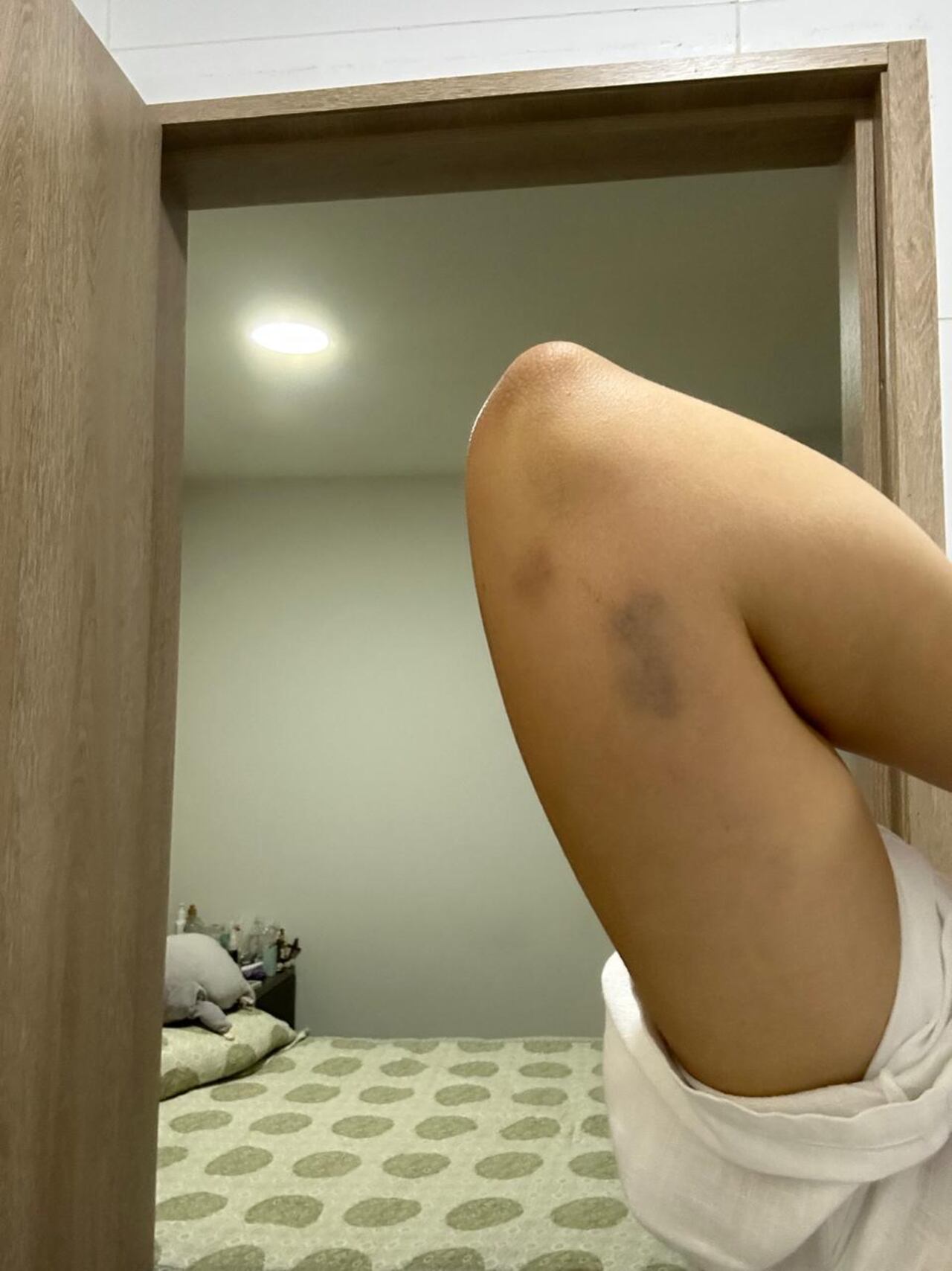 Algunas de las presuntas agresiones del concejal Castillo a su expareja sentimental.