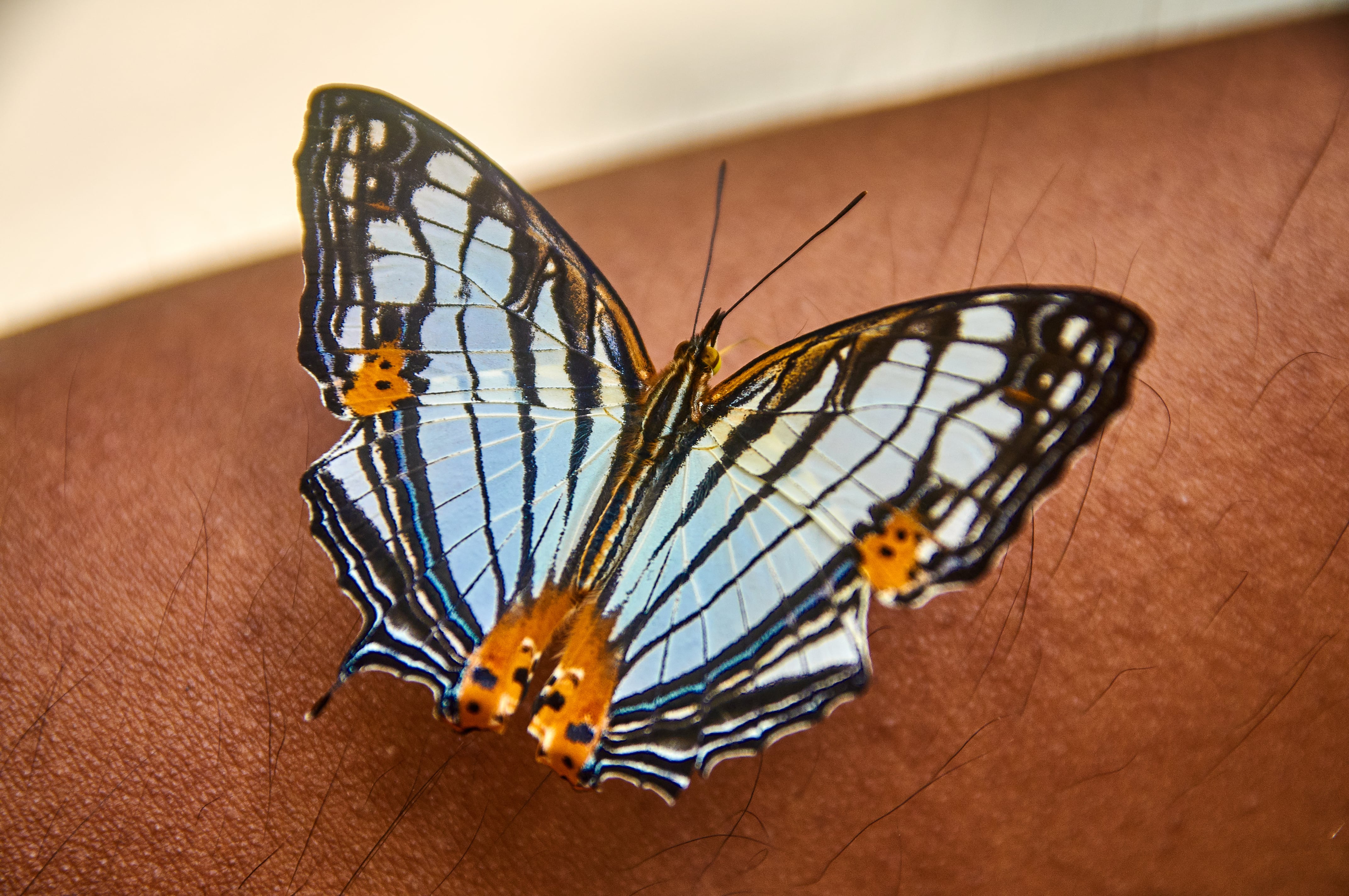 Piel de mariposa, una de las enfermedades genéticas consideradas como raras.