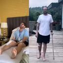 Así avanza la recuperación de Lucas Arnau tras su trasplante de rodilla.