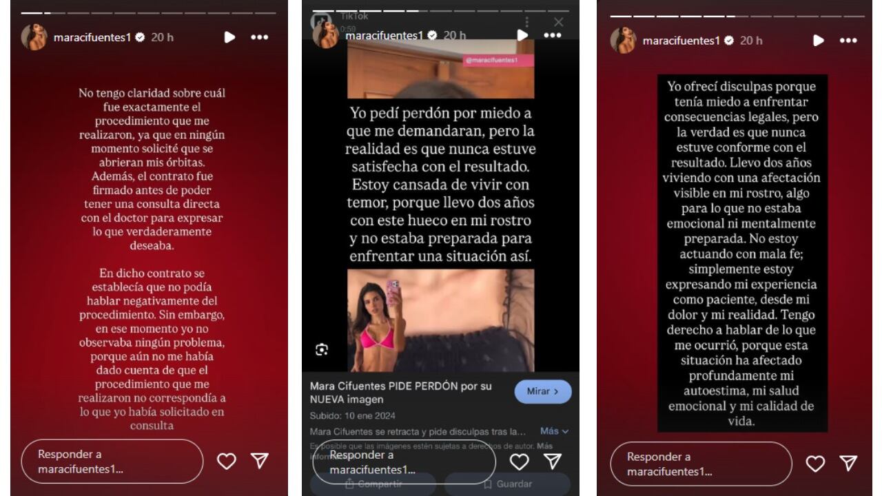 Mara Cifuentes habló de problema que lidia