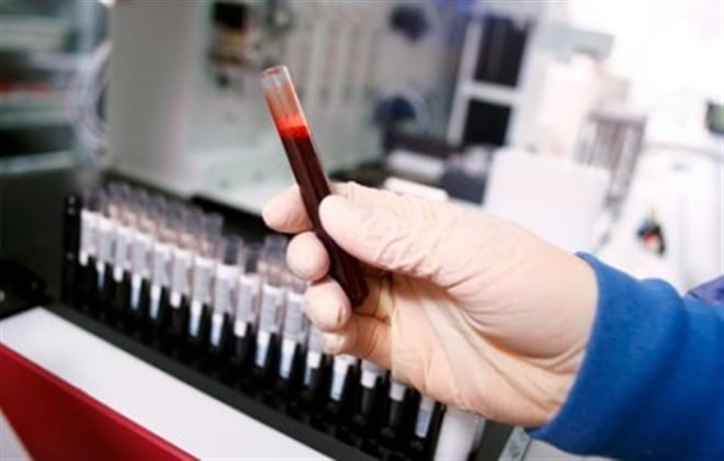 En el caso colombiano se estima que cerca de 3.000 personas padecen la enfermedad.