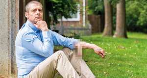 Durante seis años, Malcolm MacDonald debió llevar su pene en el antebrazo y no en el sitio correcto. Gracias a una cirugía, hoy el miembro está en su puesto.