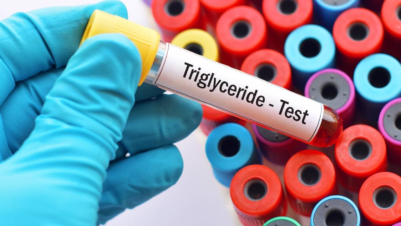 Una sana alimentación es fundamental para evitar el aumento de los triglicéridos.