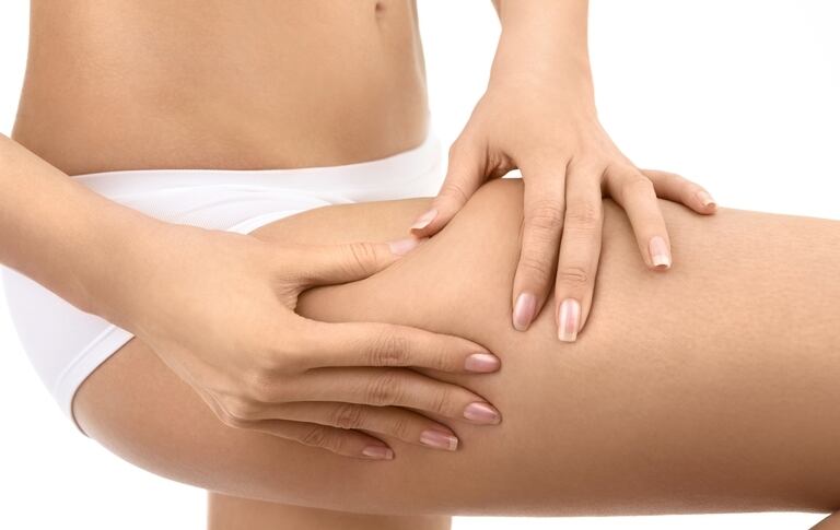 La celulitis se presenta principalmente en las mujeres. Foto: Ingimage