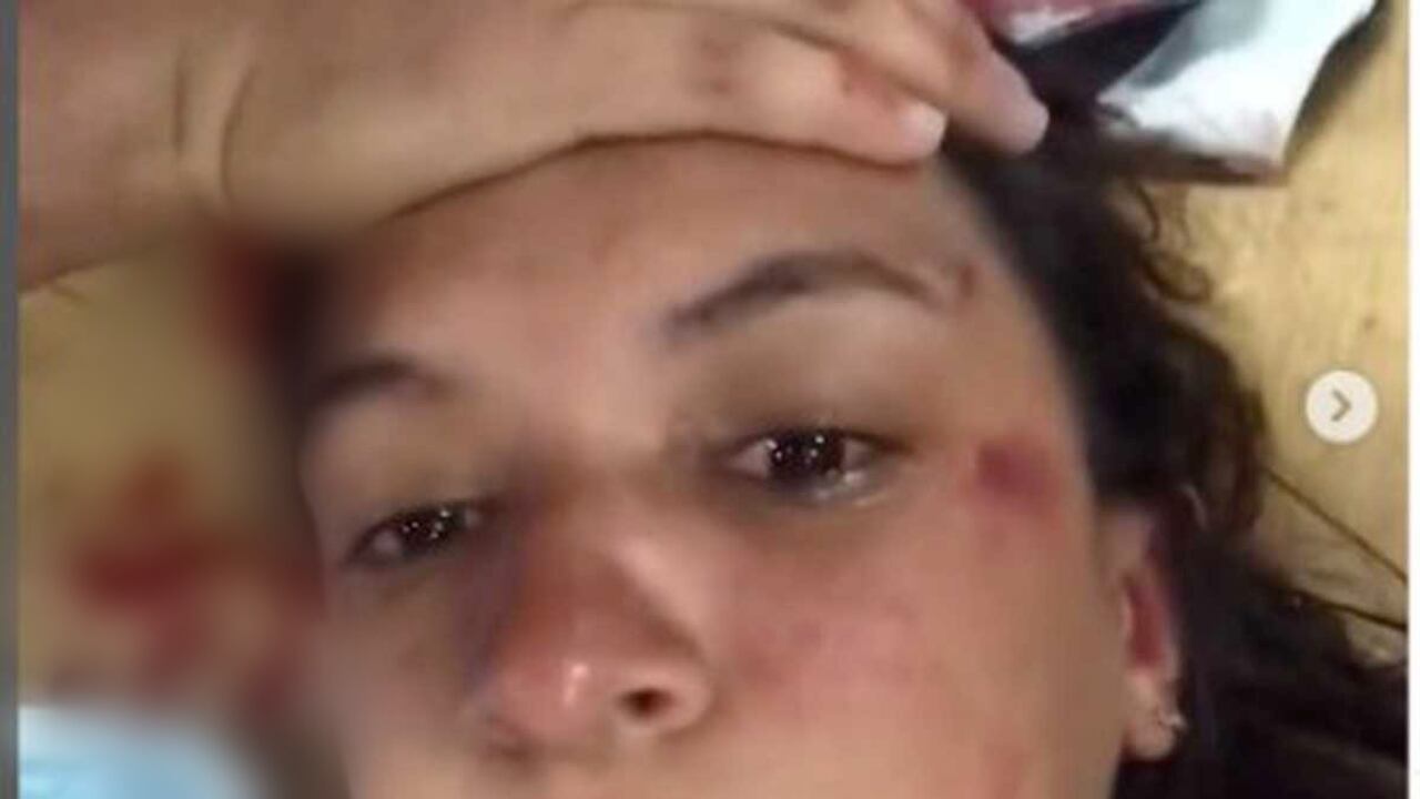 Paola Tovar, mujer agredida en la sede de Chapinero de Smart Fit denuncia negligencia por parte de la cadena de gimnasios. Dice que no tienen control sobre el tipo de personas que van a las instalaciones.