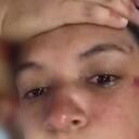 Paola Tovar, mujer agredida en la sede de Chapinero de Smart Fit denuncia negligencia por parte de la cadena de gimnasios. Dice que no tienen control sobre el tipo de personas que van a las instalaciones.