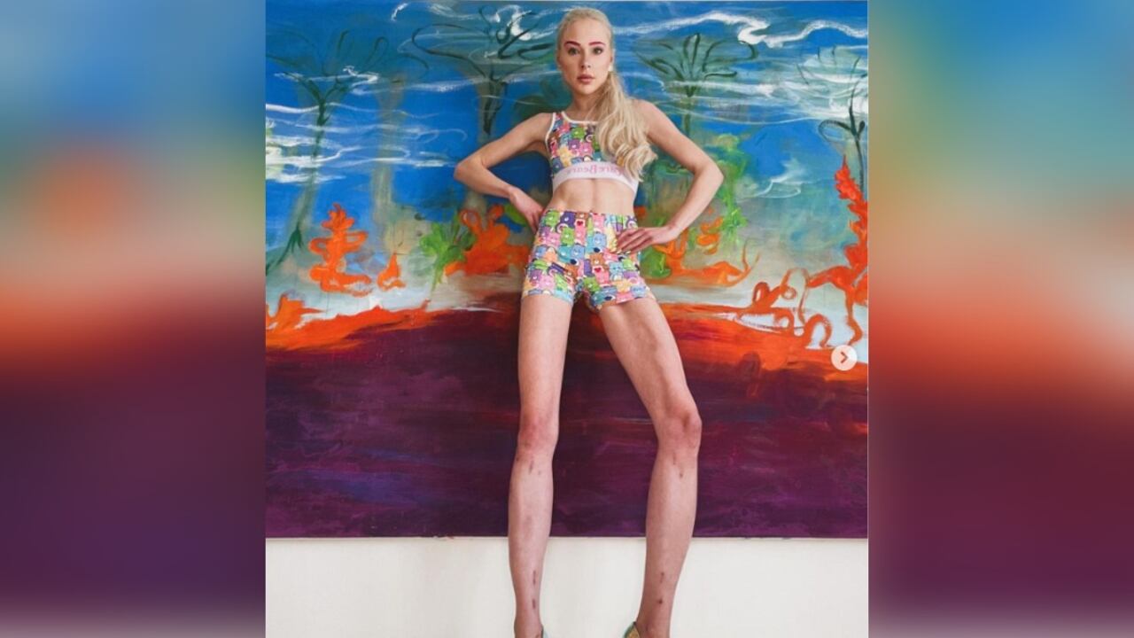 Fischer contó a la cadena radial MDR Jump cuales fueron sus verdaderas motivaciones para hacer el drástico cambio y someterse a las dolorosas intervenciones.