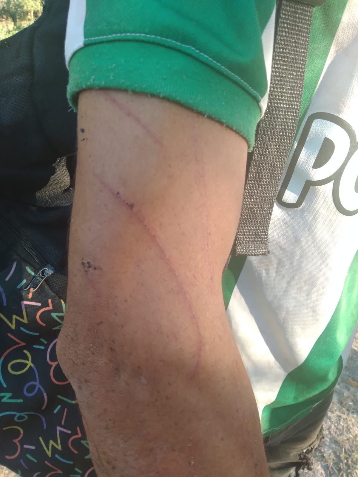 El ciudadano rescatado en el departamento del Magdalena presentaba algunas laceraciones en los brazos.