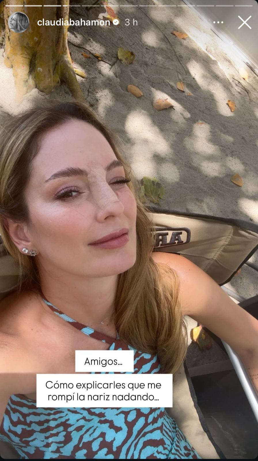 La presentadora preocupó al mostrarse vendada.