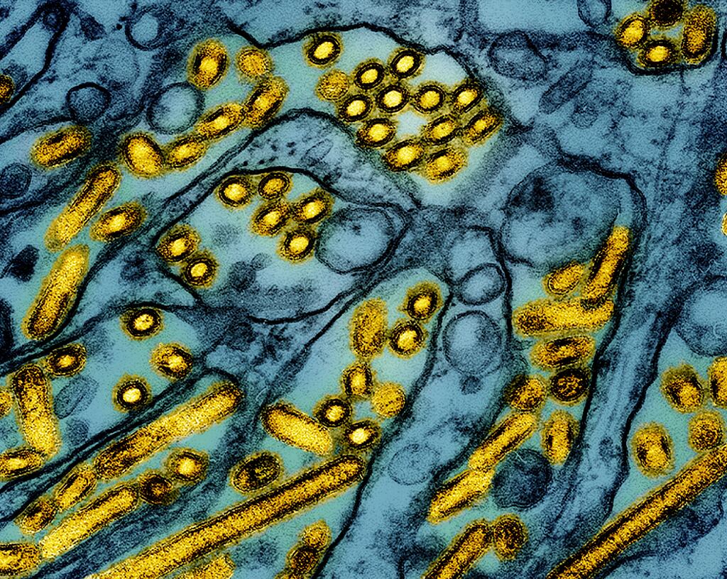 Esta imagen de microscopio electrónico coloreada publicada por el Instituto Nacional de Enfermedades Alérgicas e Infecciosas el 26 de marzo de 2024, muestra partículas del virus de la gripe aviar A H5N1 (amarillo), cultivadas en células epiteliales de riñón canino Madin-Darby (azul). (CDC/NIAID vía AP)