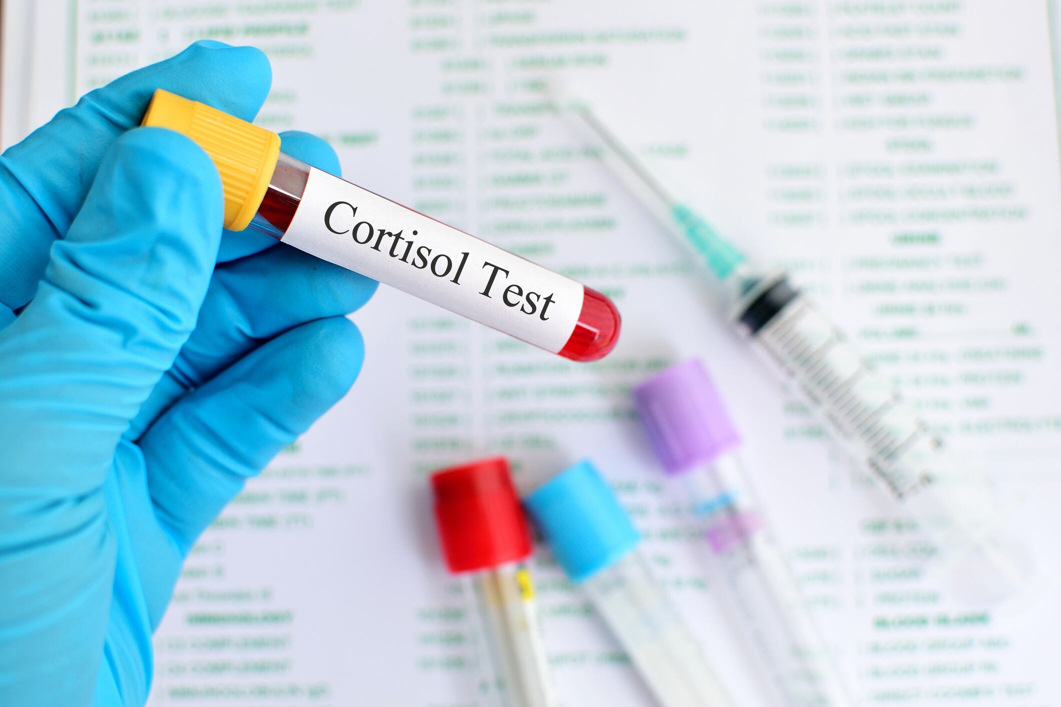 Cortisol test