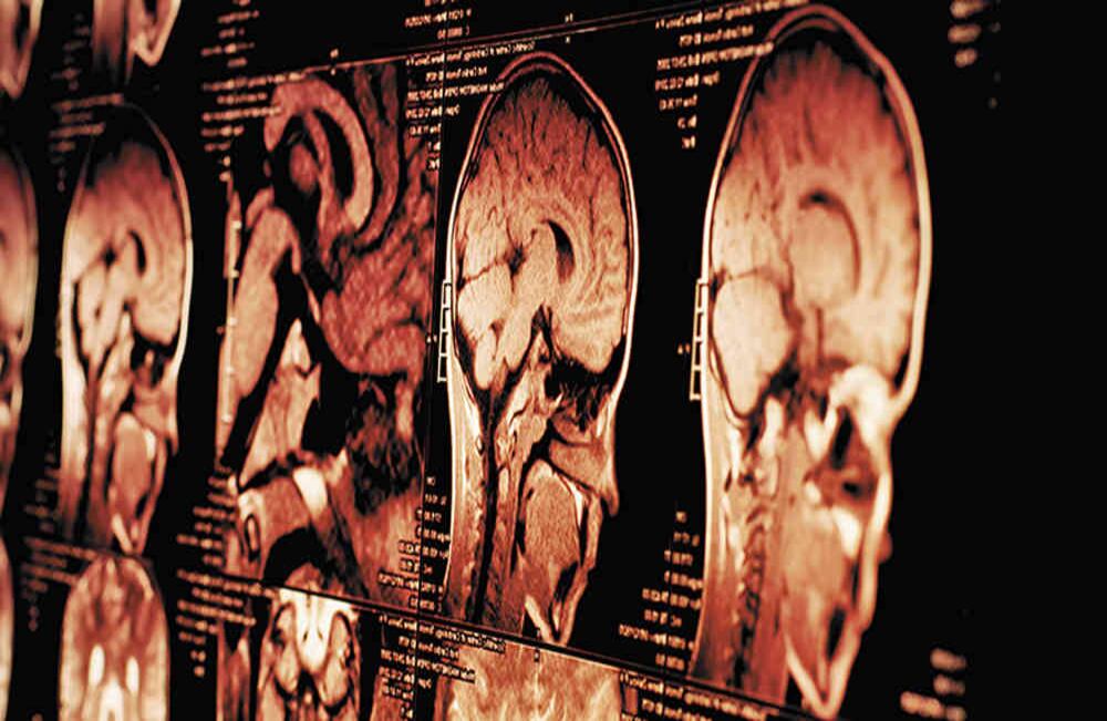  El médico Raymond Damadian demostró en 1971 la efectividad de la resonancia magnética para detectar enfermedades. Esta es una técnica vigente.