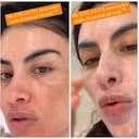 La presentadora de TV se sometió a un tratamiento para mejorar la apariencia de su rostro.