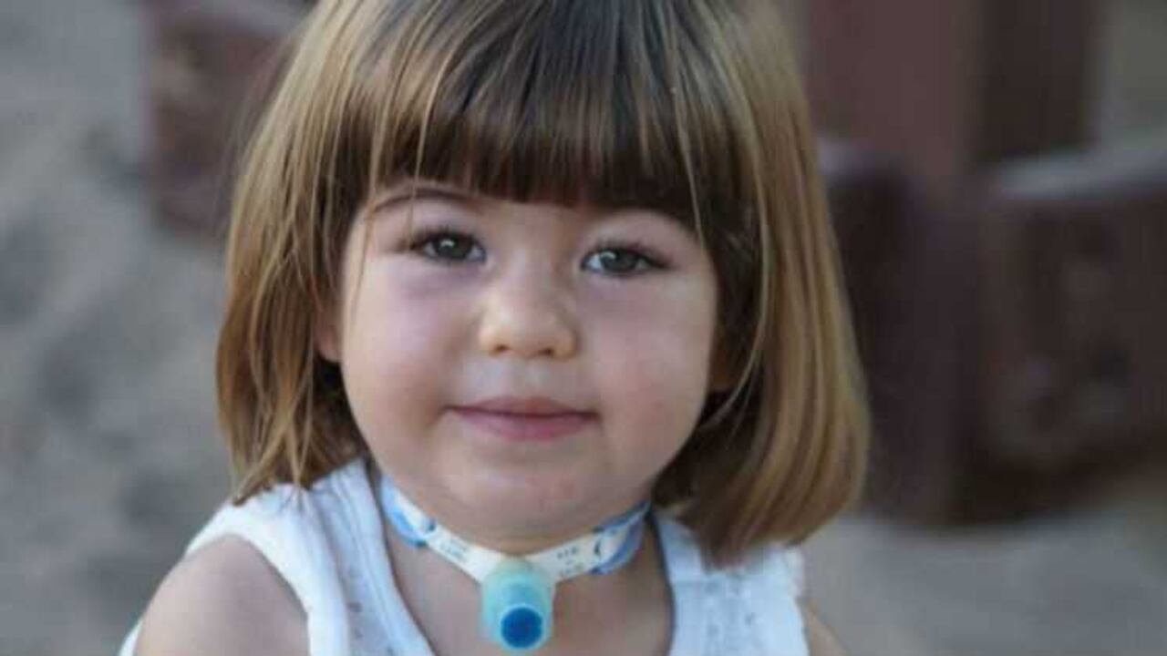 El síndrome de Ondine suele confundirse con la llamada "Muerte de Cuna", el fallecimiento súbito de los bebés cuando están dormidos.