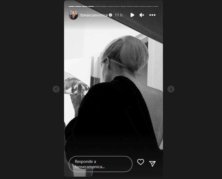 La presentadora también se quitó los implantes