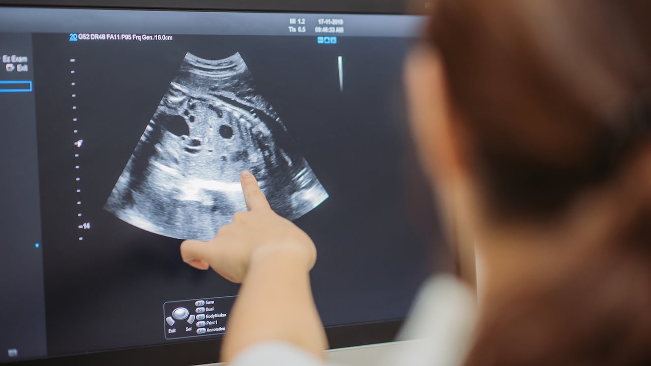 Hacer ejercicio con regularidad ayuda en gran medida a tener partos más cortos.