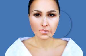 Los dermatólogos advierten sobre los factores que contribuyen al desarrollo del surco nasogeniano, desde la pérdida de colágeno hasta los hábitos de estilo de vida poco saludables.