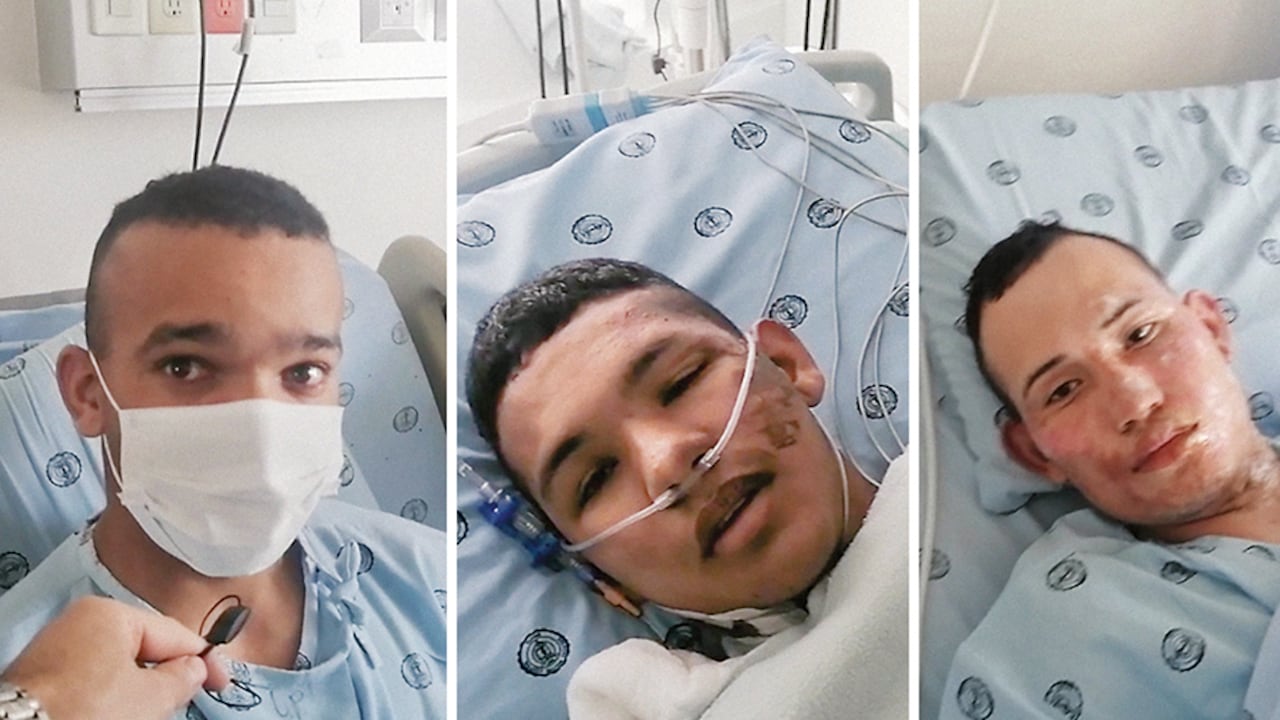 Estos son los rostros de los soldados (de izq. a der.) Díaz, Bolaños y Téllez, que sobrevivieron a un demencial atentado con granada en Puerto Inírida, Guainía.