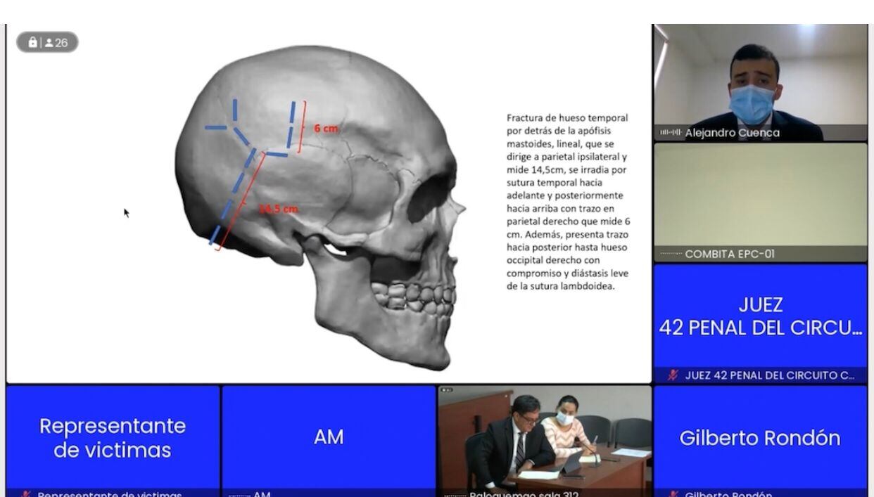 Caso Ana María Castro: Perito forense demuestra por qué sería una accidente de tránsito