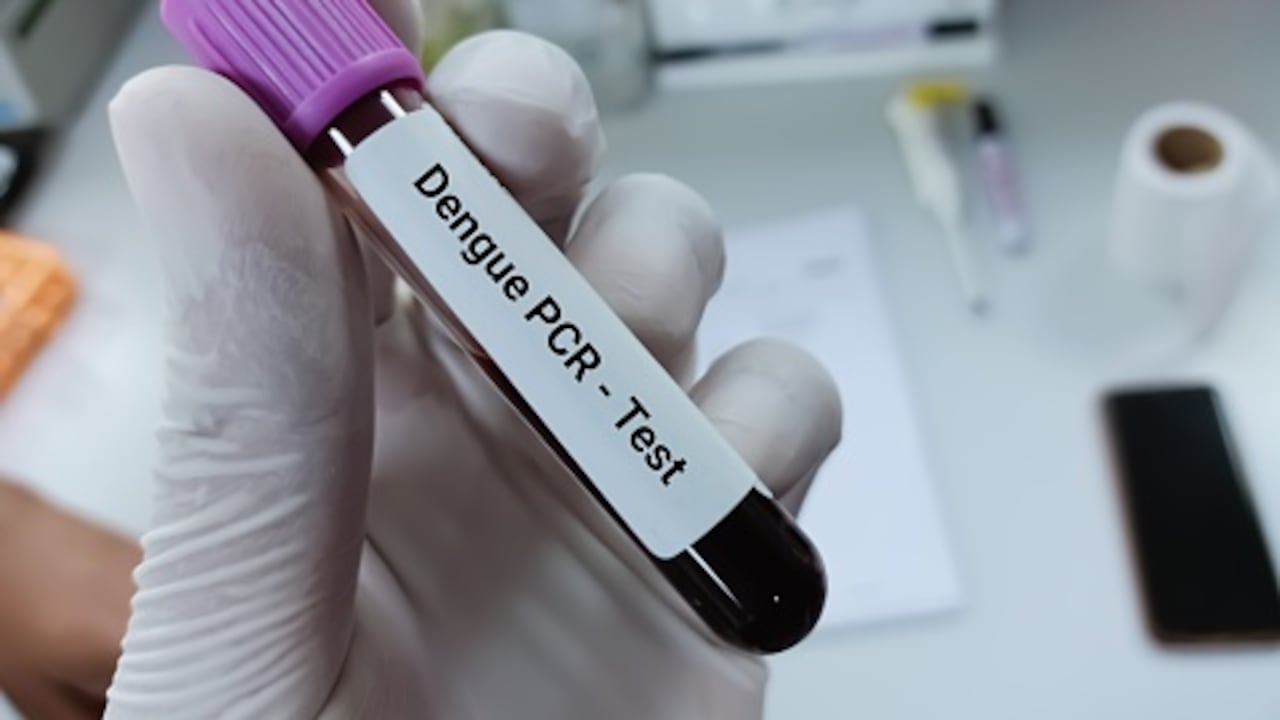 Biochemist of Scientist holds blood sample for Dengue Virus PCR test. Dengue viral load. Medical test tube in laboratory background.
