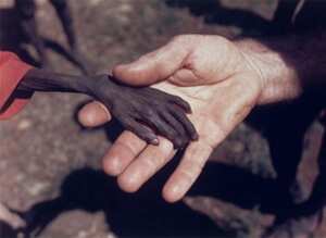 El hambre en África