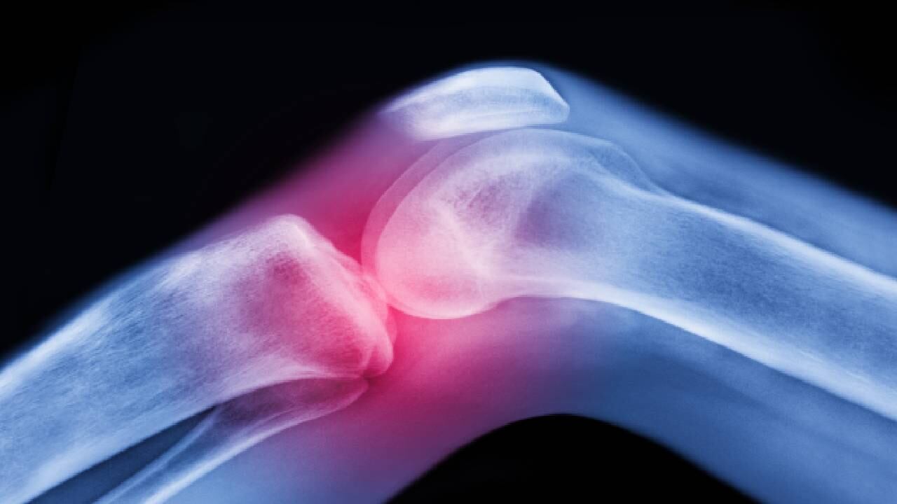 Expertos recomiendan comer vegetales verdes a diario que aportan la vitamina K2, la cual ayuda al cuidado de los huesos.  Foto: Getty images.