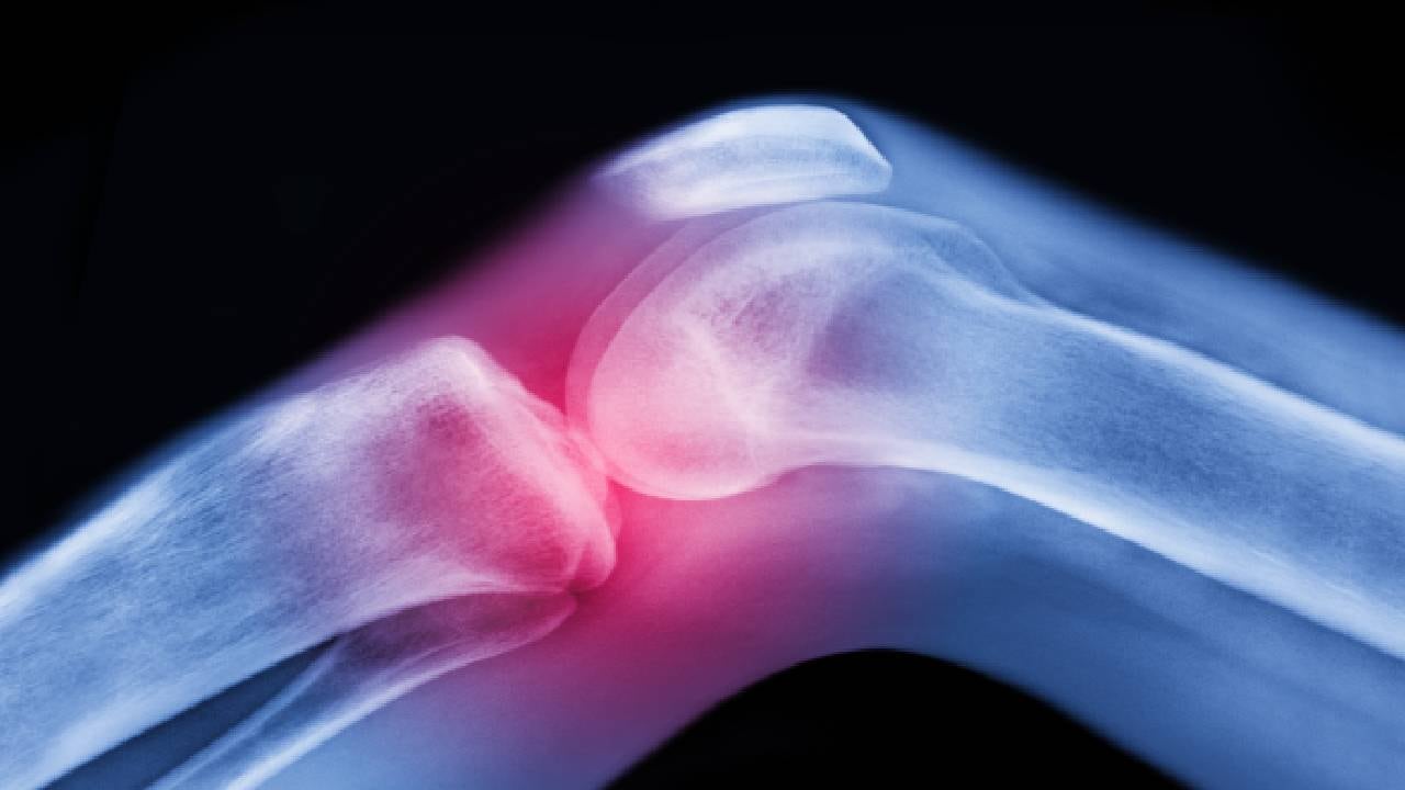 Expertos recomiendan comer vegetales verdes a diario que aportan la vitamina K2, la cual ayuda al cuidado de los huesos. Foto: Getty images.