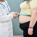 Obesity, unhealthy weight. Nutritionist inspecting a woman's waist using a meter tape to prescribe a weight loss diet