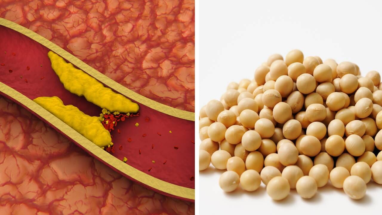 La lecitina de soya permite acelerar el metabolismo.