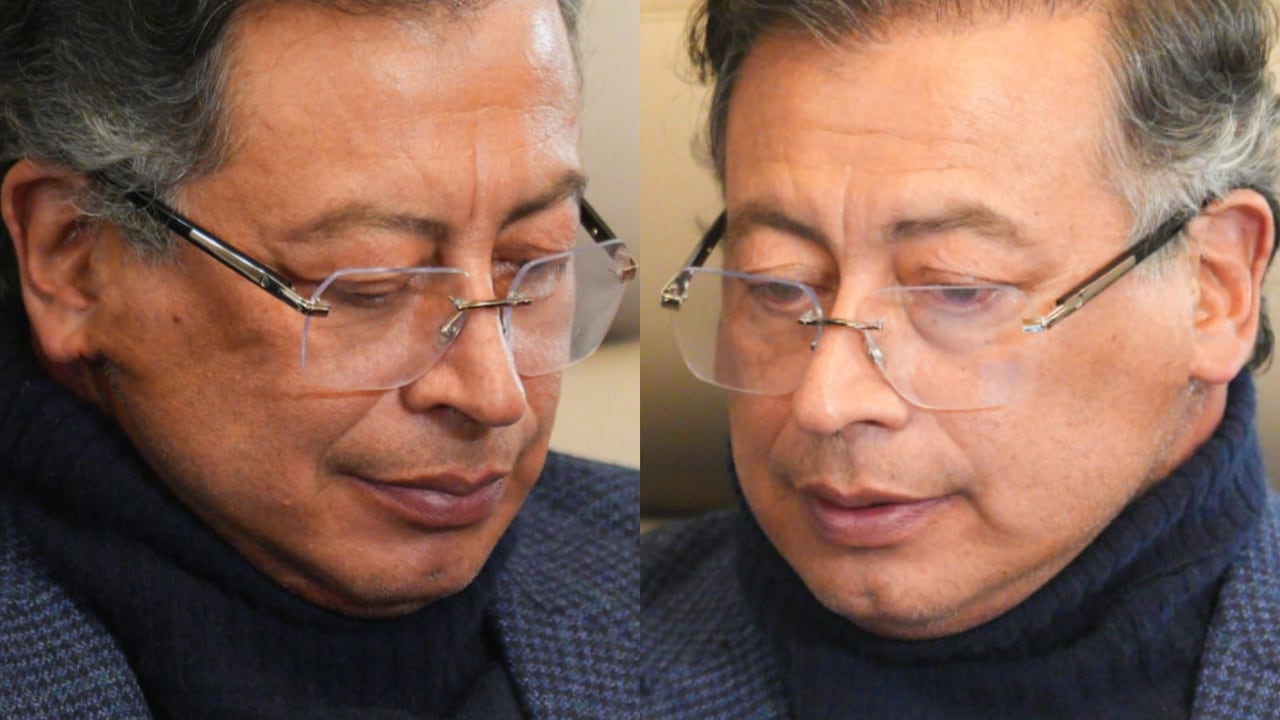 El presidente Petro se sometió a cirugía plástica sin informar al Congreso