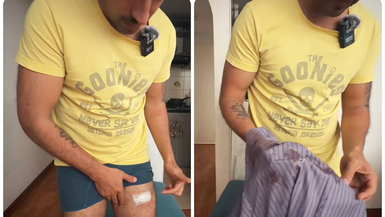 Diego Andariego fue herido con un proyectil.