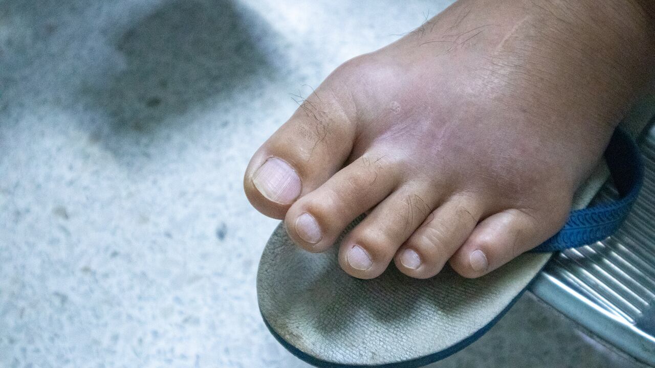 Es importante observar cualquier otra señal que estaría alertando de una posible enfermedad.