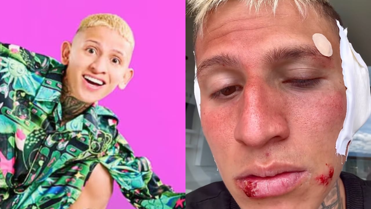 El creador de contenido preocupó a sus seguidores al publicar las imágenes.