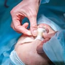 Karen Julieth se realizó una rinoplastia en una clínica de Floridablanca, Santander.