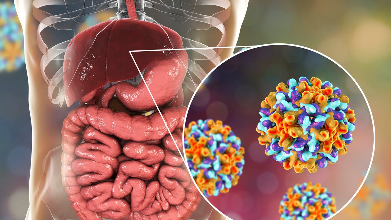 La hepatitis aguda grave de causa desconocida, ha sido detectada en Israel, Estados Unidos, Argentina y algunos países de Europa.