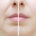 Existen remedios caseros para eliminar estas imperfecciones del rostro.