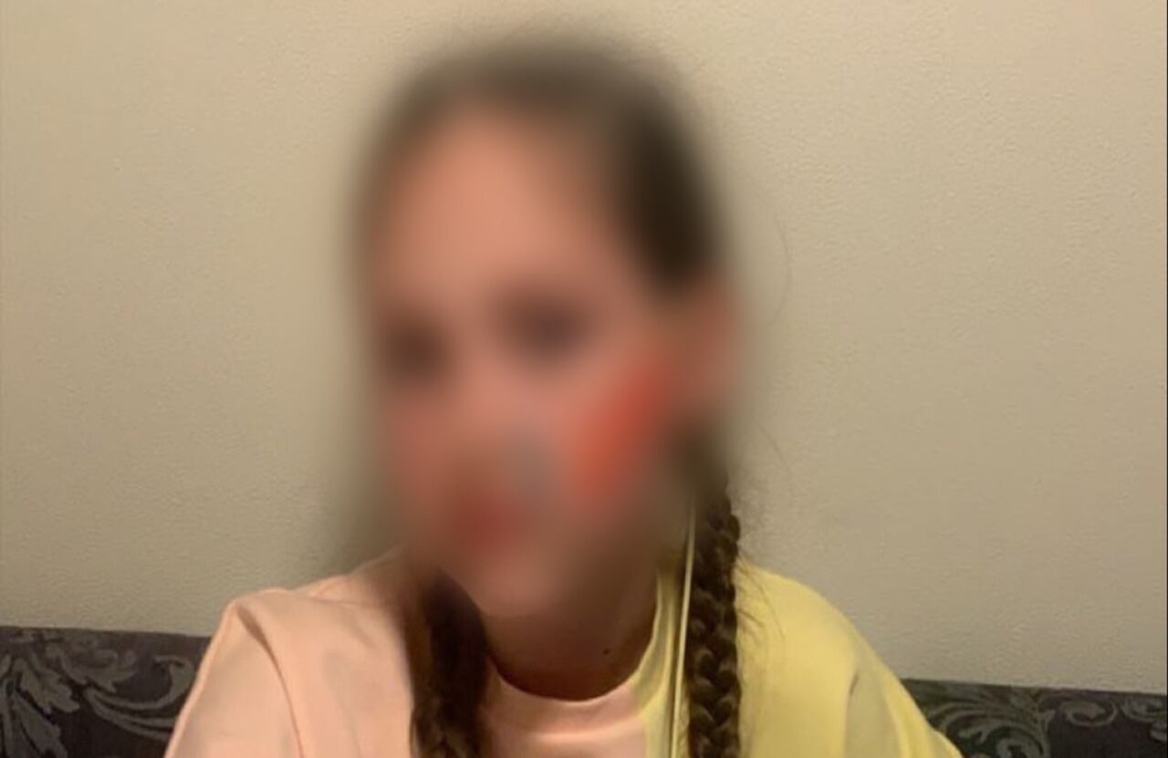 La niña es uno de los 87 mil menores de edad que luchan con los efectos a largo plazo del coronavirus;