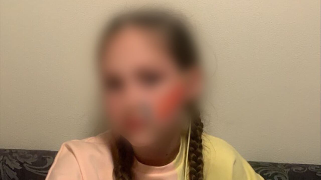 La niña es uno de los 87 mil menores de edad que luchan con los efectos a largo plazo del coronavirus