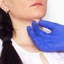 Aceites y algunos ejercicios pueden mejorar la apariencia de la papada.