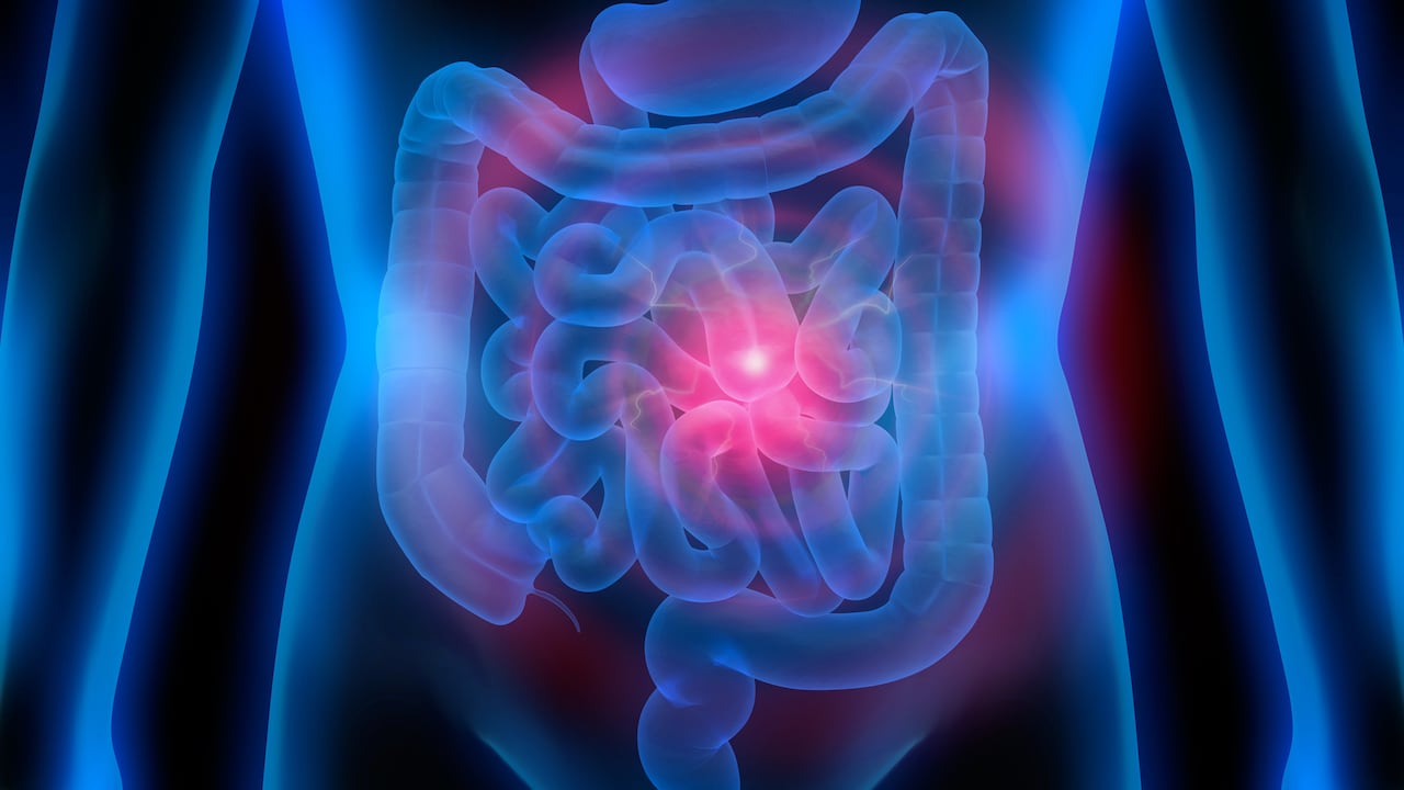 ¿Cómo limpiar el intestino de forma natural?