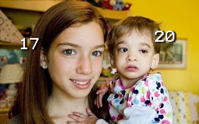 Brooke Greenberg fue diagnosticada en su momento con el 'Síndrome X'.