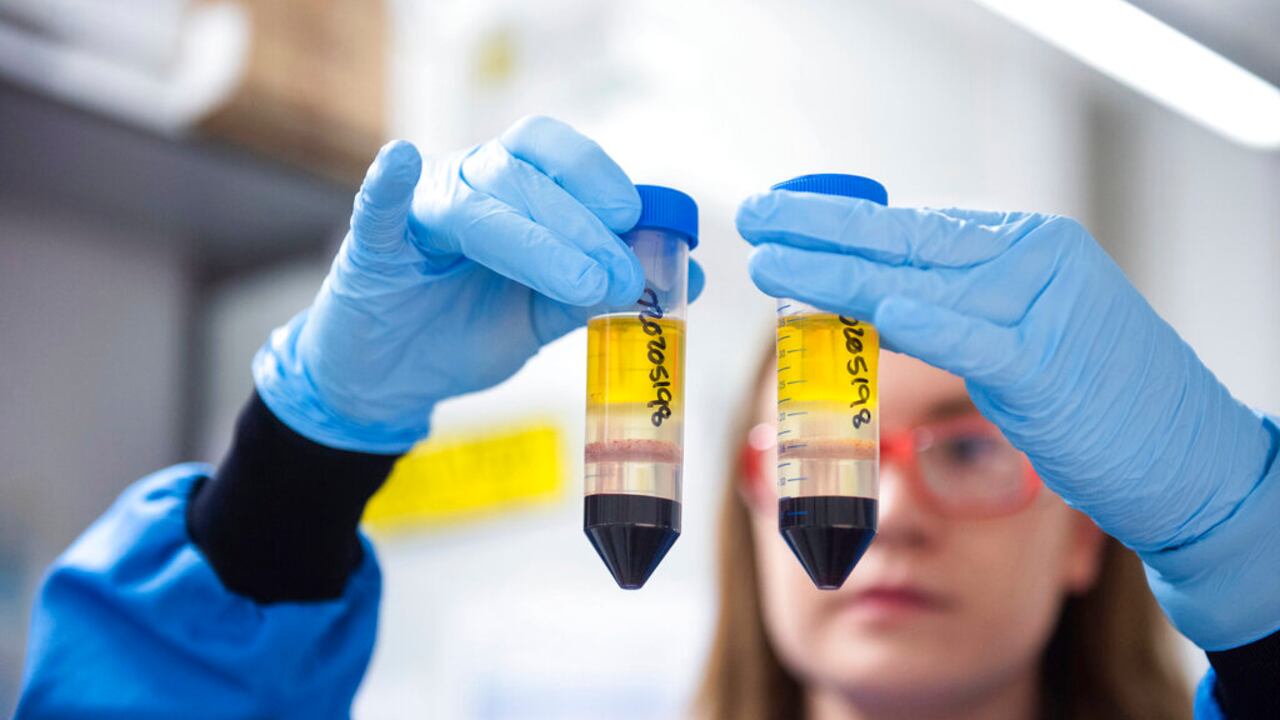 En esta imagen difundida por la Universidad de Oxford el lunes 23 de noviembre de 2020, una investigadora en un laboratorio del Instituto Jenner en Oxford, Inglaterra, trabaja en la vacuna contra el coronavirus que desarrollan AstraZeneca y la Universidad de Oxford. (Universidad de Oxford/John Cairns v�a AP, archivo)